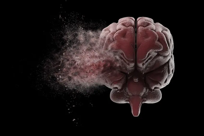 Medical illustration showing traumatic brain injury and concussion caused by car accident impact force